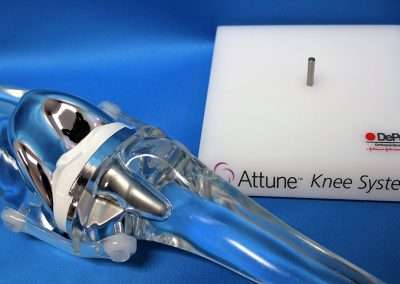 Acrylic knee model