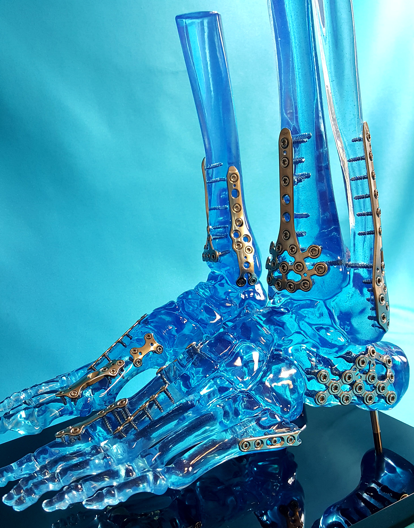 Tinited Acrylic Extremity Foot Display Models Encoris 1