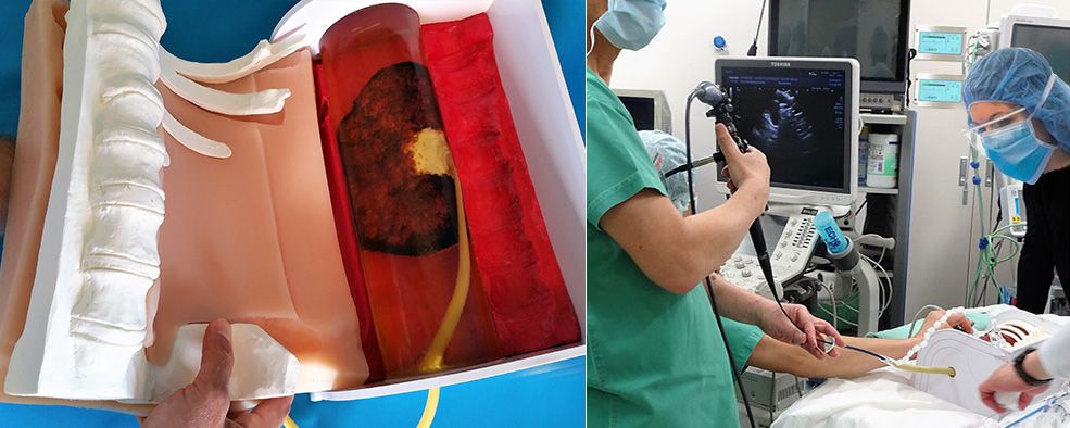Remote PCNL Kidney Training Provides Medical Students and Surgeons a Realistic Training Experience