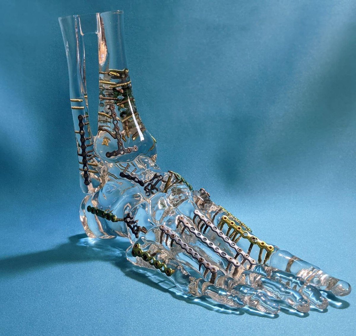Acrylic foot and ankle model fracture plates