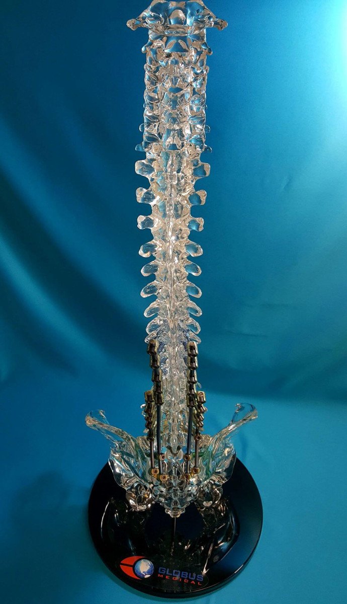 Clear acrylic full spine pedicle screw model