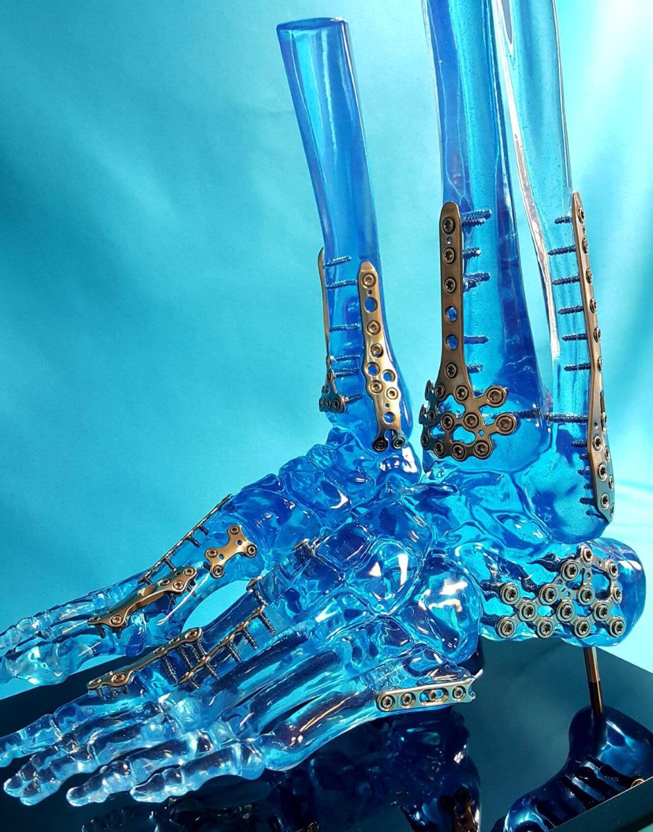 tinted acrylic extremity foot display models by Encoris
